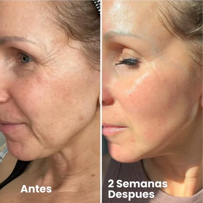 Vaelia® Retinal Shot - Adios Arrugas y Flacidez