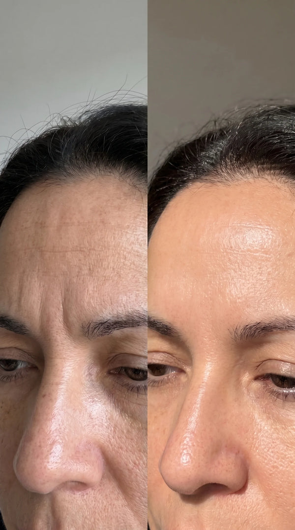 Before and after