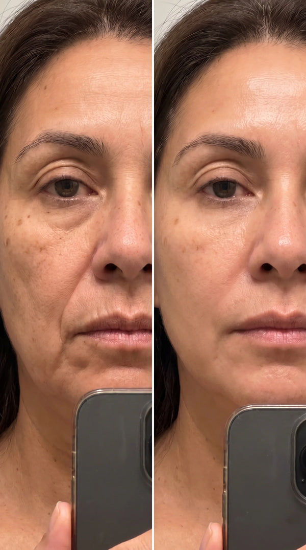 Before and after