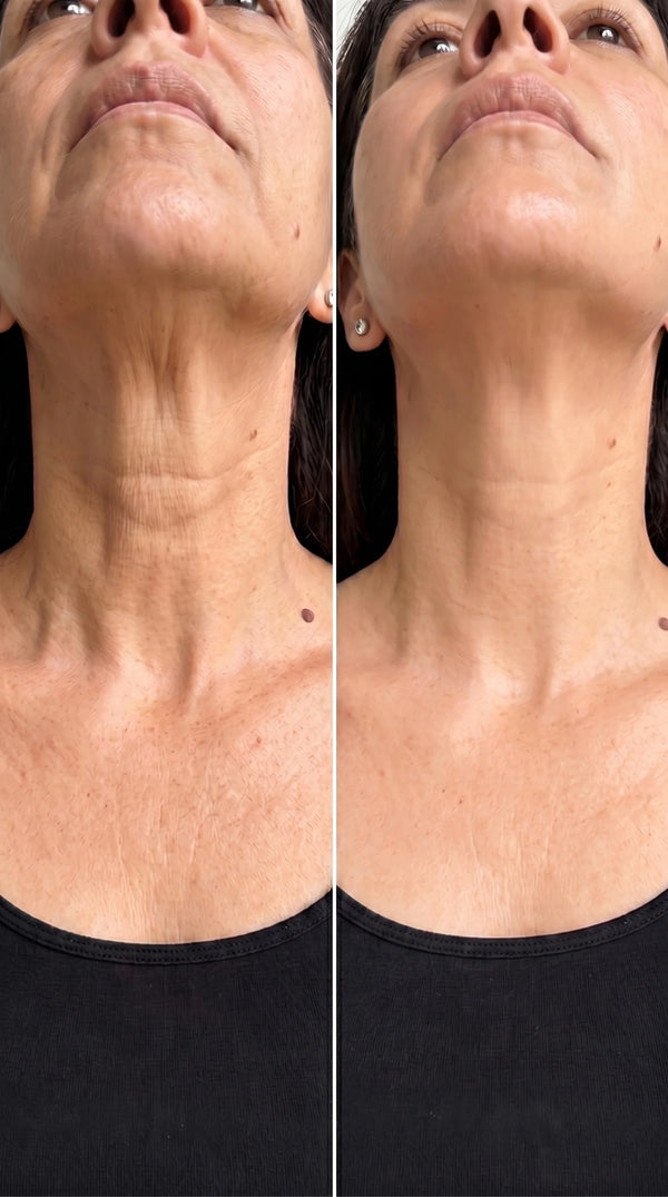 Before and after